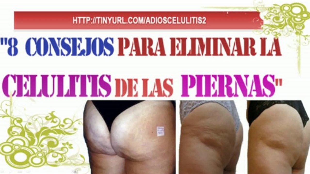Como Eliminar La Celulitis De Las Piernas-Remedios Contra Celulitis