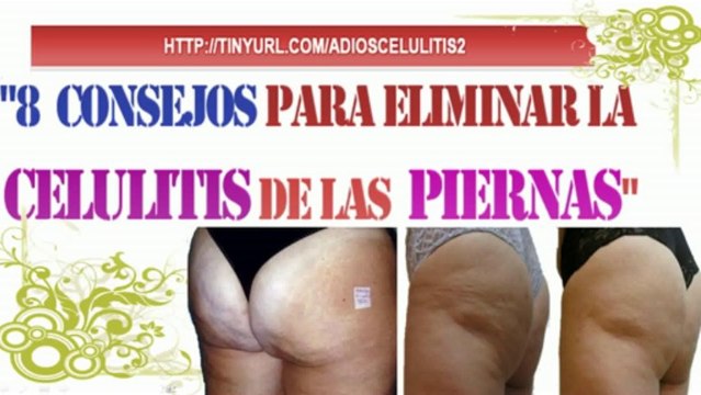 Como Eliminar La Celulitis De Las Piernas-Remedios Contra Celulitis