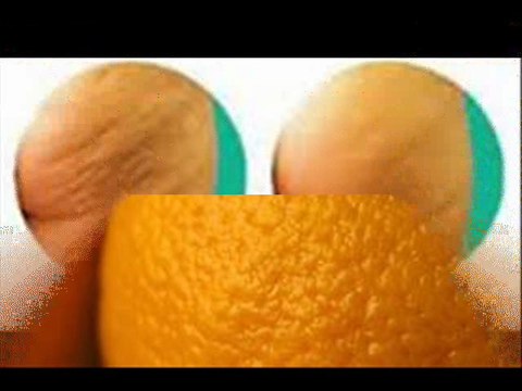 CELULITIS Eliminar la celulitis para siempre Adios Celulitis