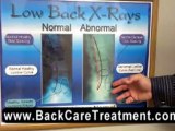 Tips to get rid of low back pain