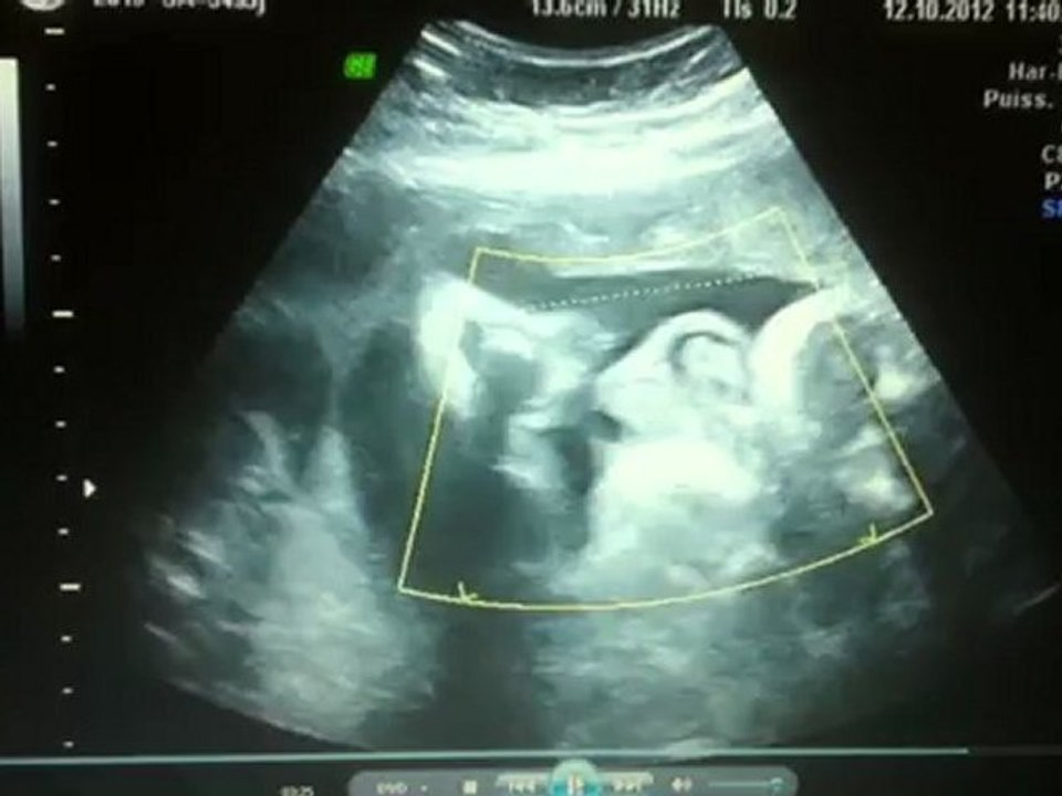 Léon in ventro 8 mois