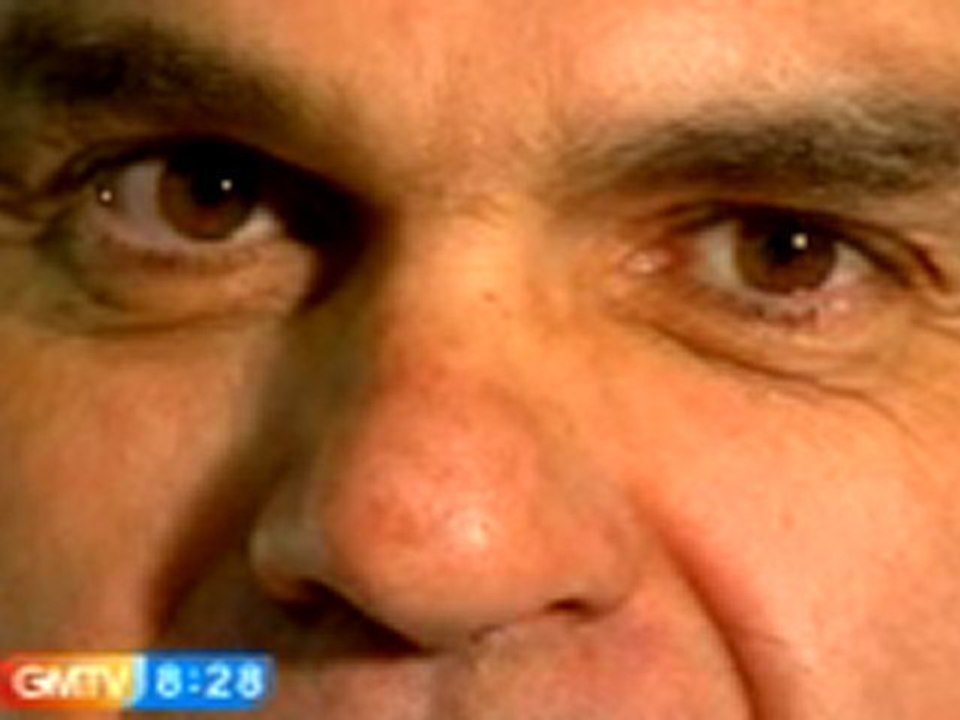 One Stitch Facelift, Beverly Hills