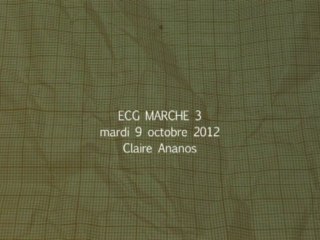 ECG MARCHE 3