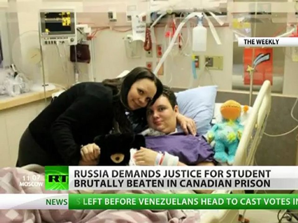 Brutally Beaten: Russia demands justice for student attacked in Canada prison