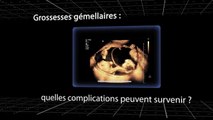 Enceinte de jumeaux : quels sont les risques ?