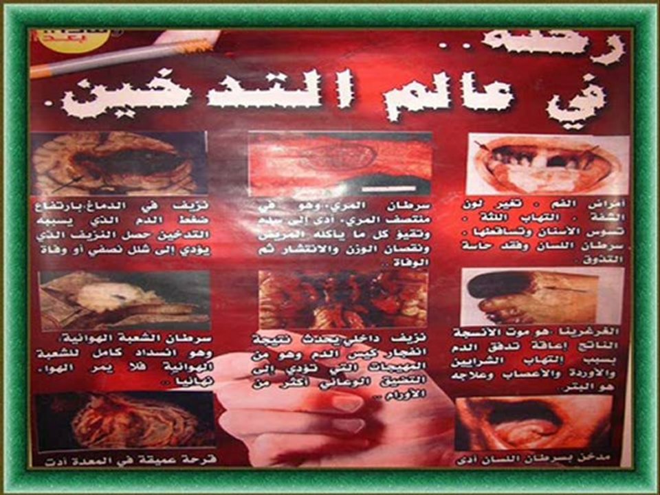 موعظة مؤثرة و صور جد معبرة عن خطورة التدخين مع الشيخ محمد حسان