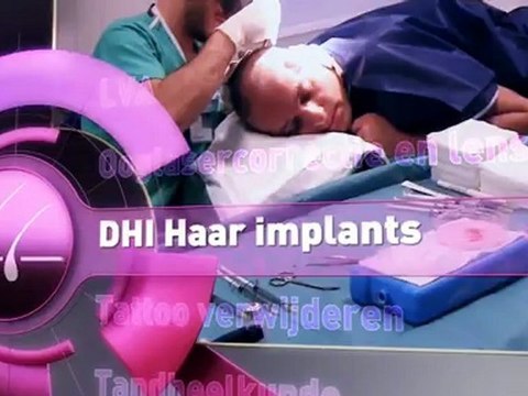 Voor haartransplantatie DHI behandeling is een goede oplossing