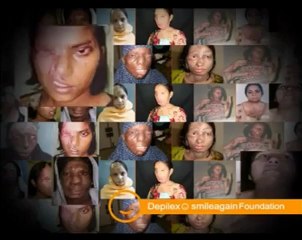 Stories of Extraordinary Hope in Depilex Smileagain