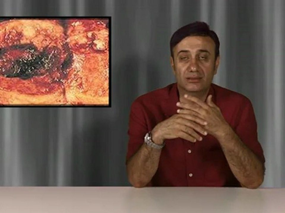 Rahim kanseri tanısı nasıl konur?