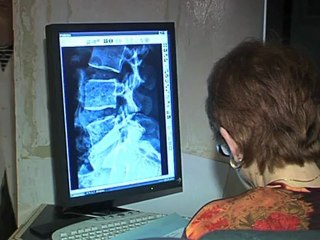 Radiographie : comment ça marche ?