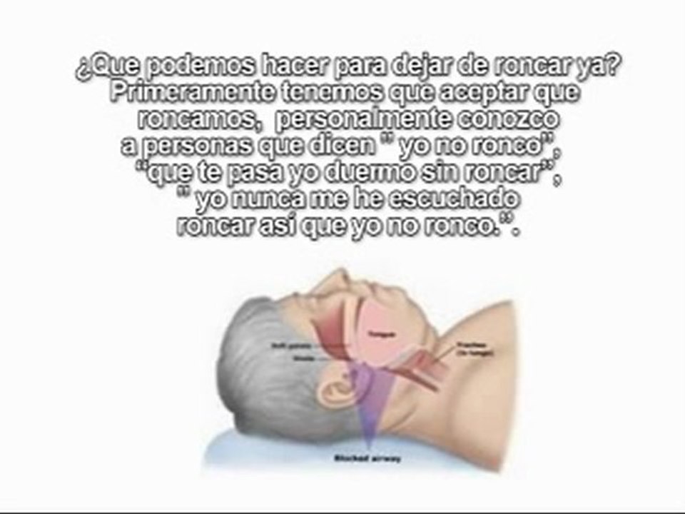 DEJAR DE RONCAR YA