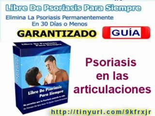 CÓMO CURAR LA PSORIASIS EN 30 DÍAS O MENOS