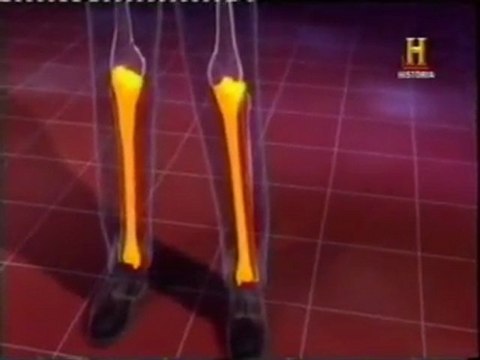 Huesos y protesis oseas: Punto de ruptura