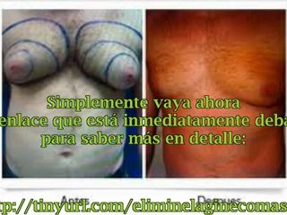 Como curar la ginecomastia sin cirugia