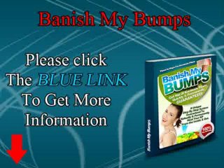 Best Natural Treatment for Keratosis Pilaris