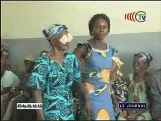 59 personnes ont bénéficié des soins gratuits pour des pathologies oculaires à Oyo