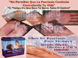 LIBRE DE PSORIASIS EN 30 DÍAS O MENOS