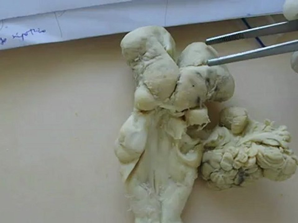 Anato I encefalo parte 2