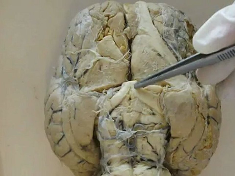 Anato I Encefalo parte 1