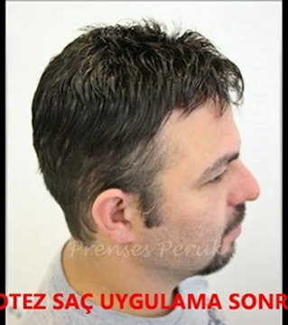 Prenses Peruk Protez Saç Ankara 0312 4193707