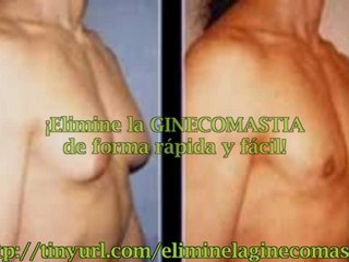 Como eliminar la ginecomastia sin cirugia