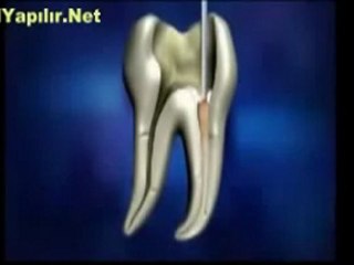 Kanal Tedavisi Nasıl Yapılır? | NasılYapılır.Net |