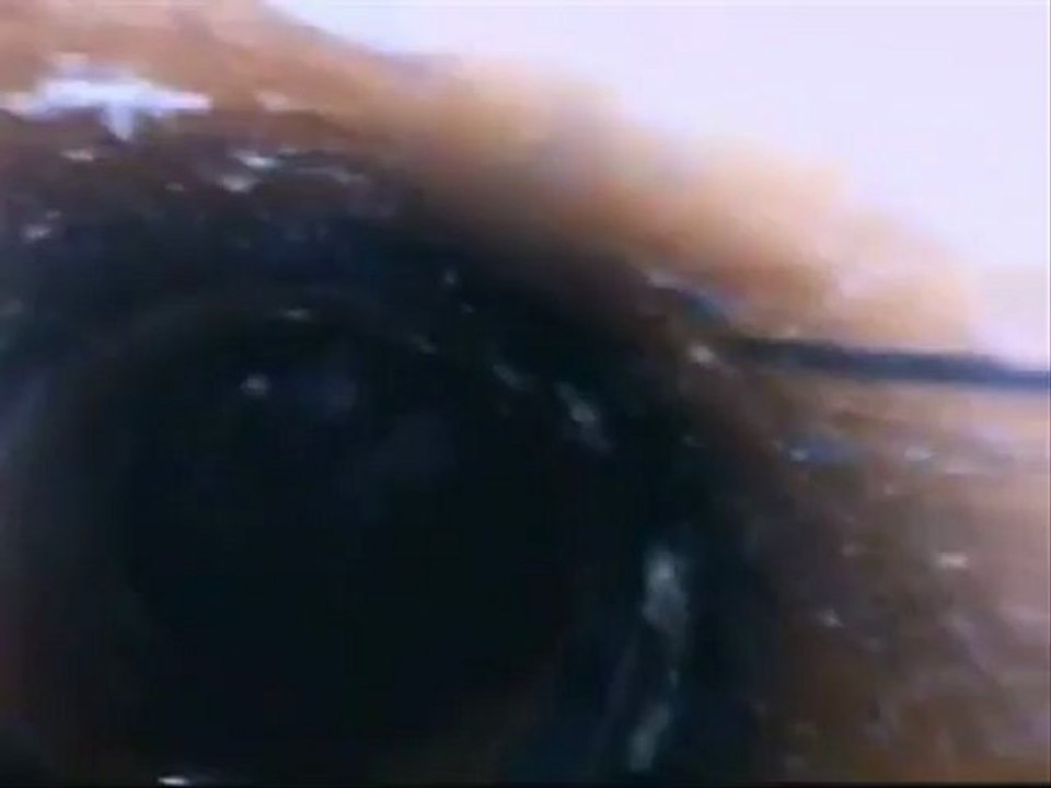 endoscope articulable 360