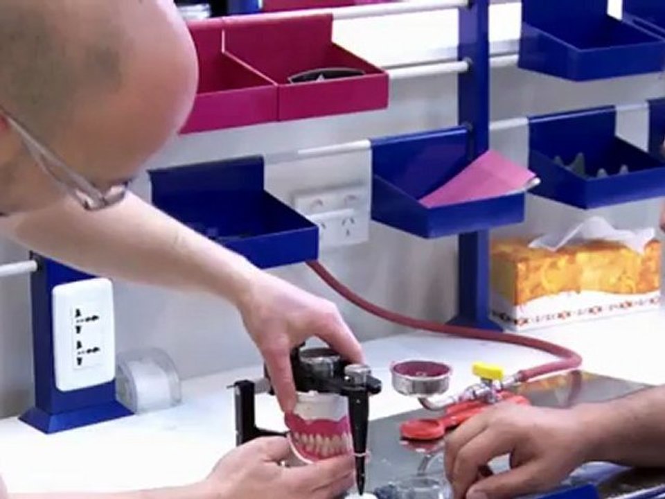 All on 4 Plus Dental Implants, the Permanent Alternative to Dentures or Deteriorated Teeth