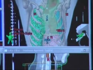 Здоровые истории в Лисод