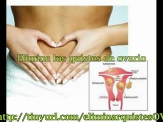 QUISTES EN OVARIOS TRATAMIENTO NATURAL