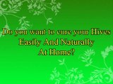 How to Cure Hives Naturally at Home