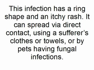 Fast, Effective Ringworm Treatment