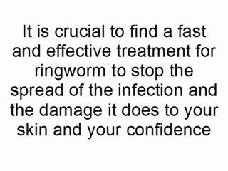 Top 3 Treatments For Ringworm