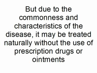 New Treatments For Ringworm