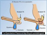 A La Eyaculacion Precoz - Solucion