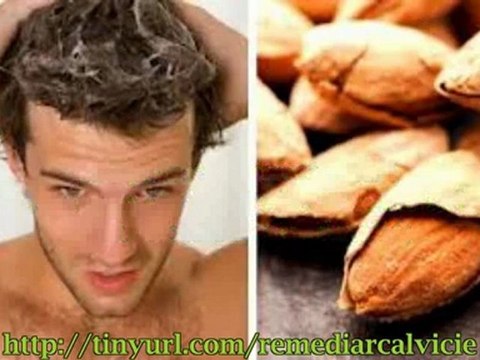 Evitar la caida del cabello en hombres