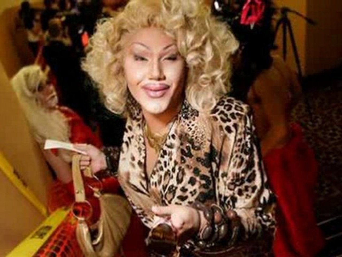 The Horrors of Plastic Surgery