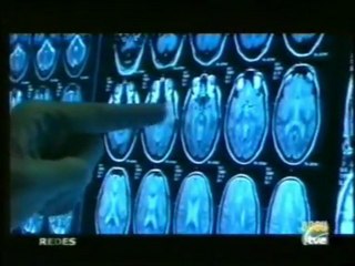 Plasticidad cerebral: Guttmann