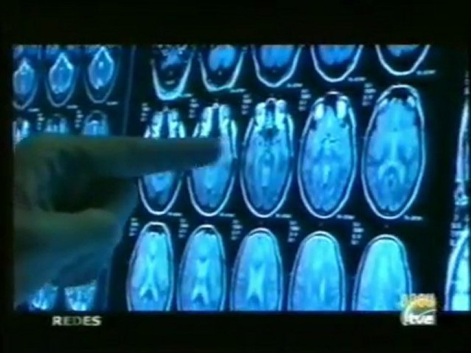 Plasticidad cerebral: Guttmann