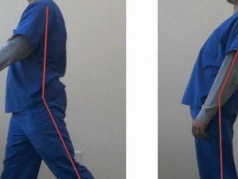 Ejercicio FACIL Para Hernia de Disco y Dolor de Espalda