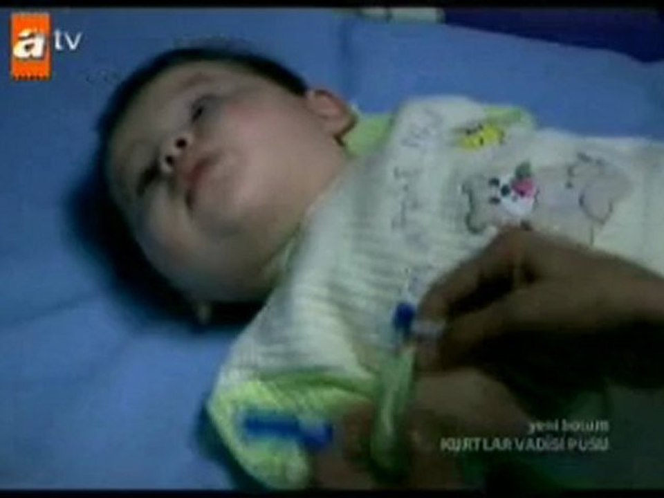 kurt 170 part 3