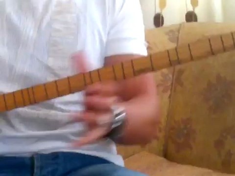 değirmen başında vurdular beni ..!