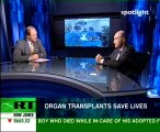 Organ transplants save lives