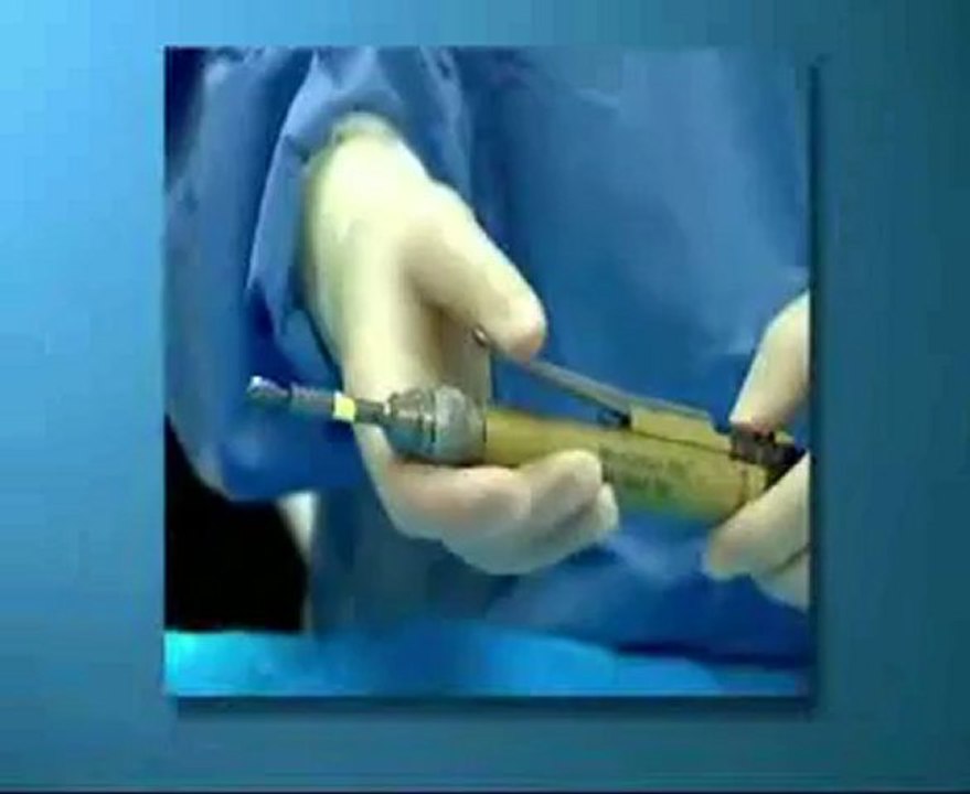 Medical Extrusion