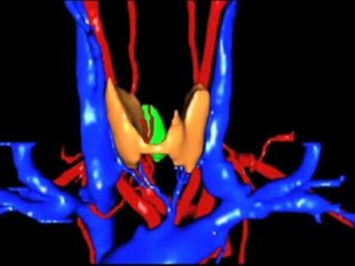 La simulation numérique pour la santé