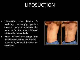 Adverse effects to health due to these veins