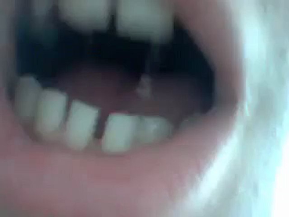 Mega rutto forte e altri rutti - Mega burp and other strong