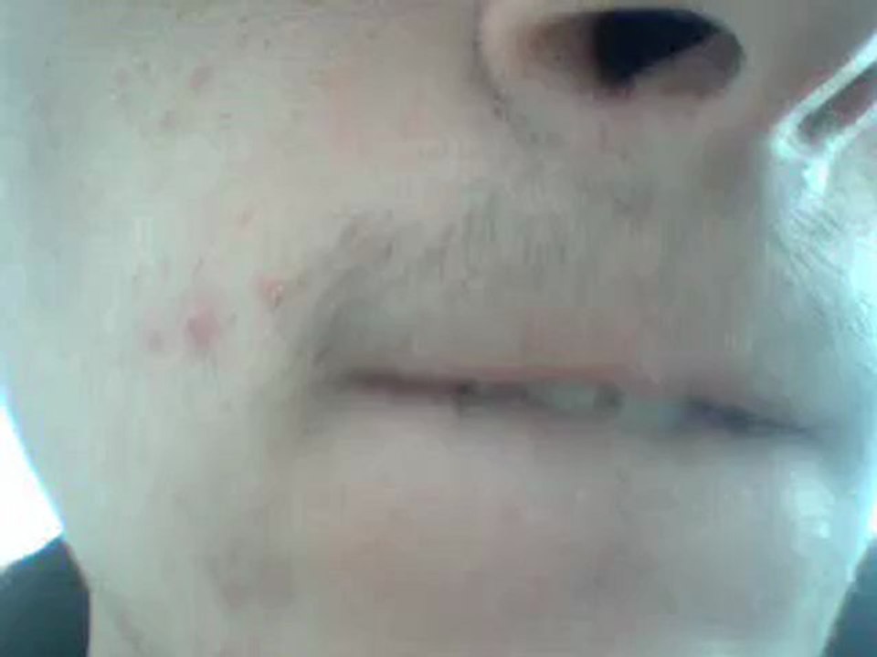 Rutto forzato e serie di rutti in ripetizione