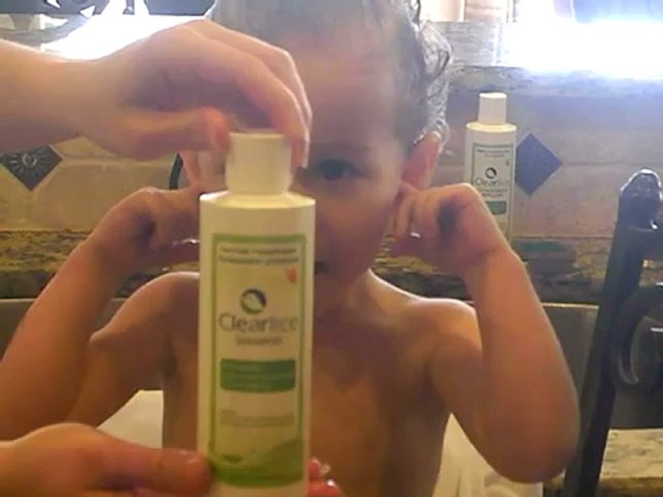 Head Lice Treatment | (800) 294-6816 | Clearlice Head Lice Treatment Video