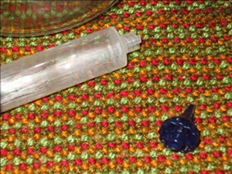 SUDDEN ONSET DEAFNESS CURED - EAR SYRINGE REVIEW